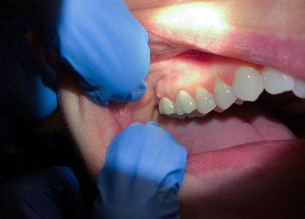 Best Urgent Tooth Repair  in Morgan Hill, PA