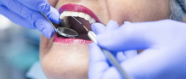 Best Chipped Tooth Repair Near Me  in Morgan Hill, PA